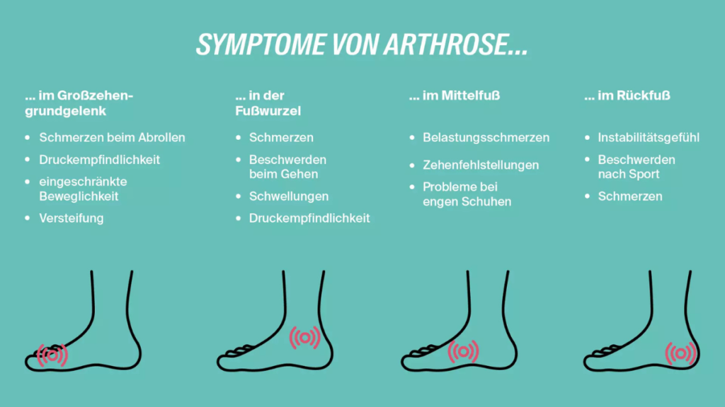 arthrose im fuß was hilft hausmittel